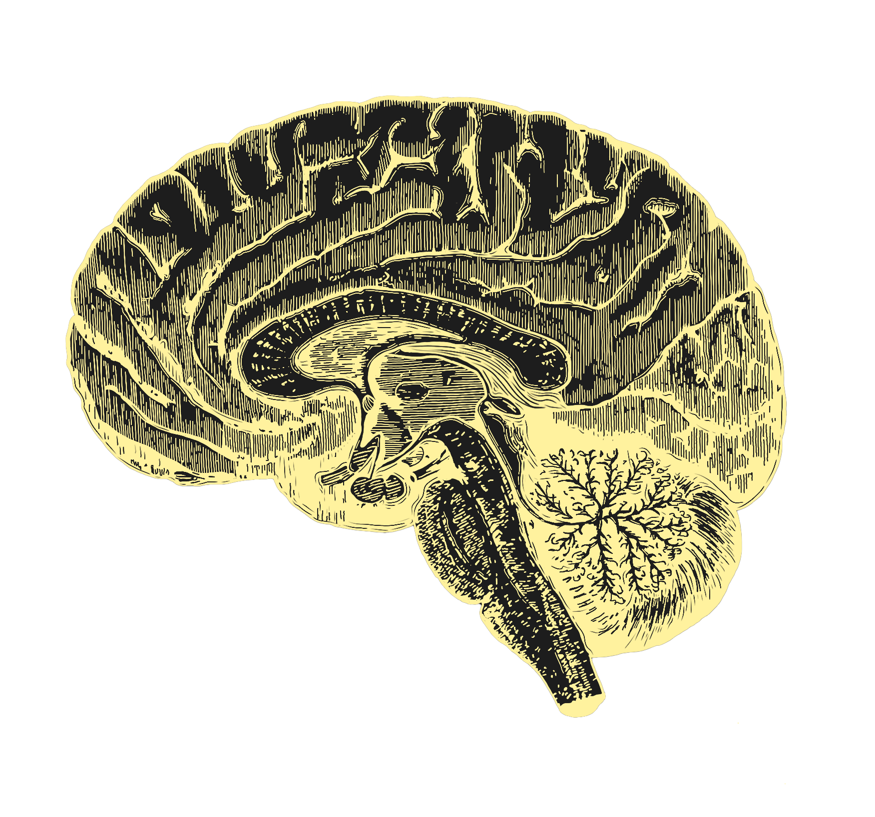 Brain overlay