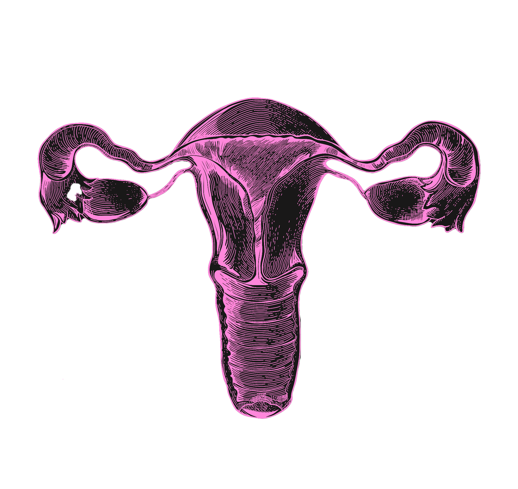 Uterus overlay